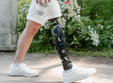 Jak wygląda proteza sportowa i czym się wyróżnia?