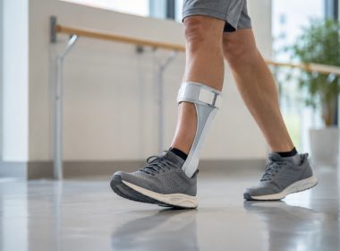 Orteza na opadającą stopę jako realne wsparcie w codziennym chodzeniu